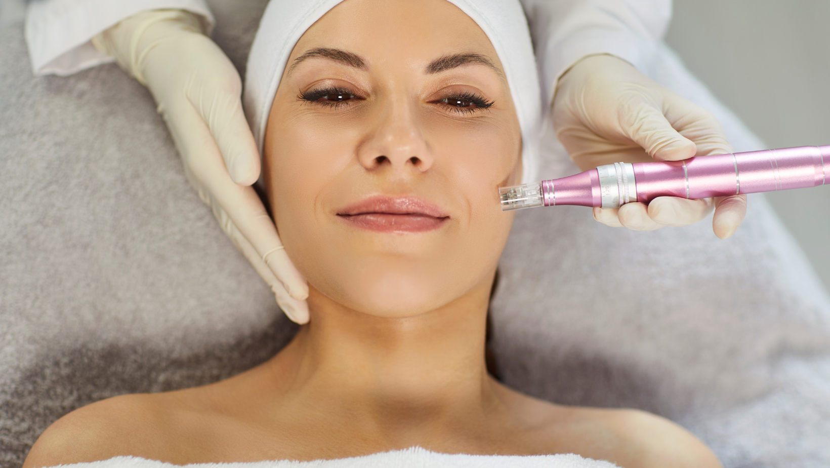 Skin Needling